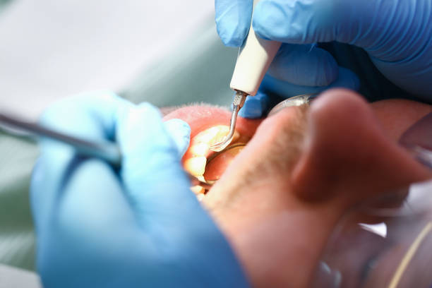 Best Emergency Cosmetic Dentistry in Moweaqua, IL