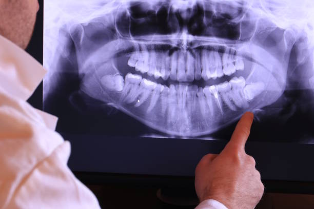 Best Emergency Dentist for Special Needs Patients in Moweaqua, IL